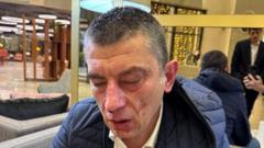 Georgian opposition leader beaten up, blames governing party members