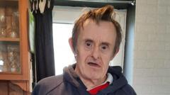 Man died after being bitten by dogs, inquest told