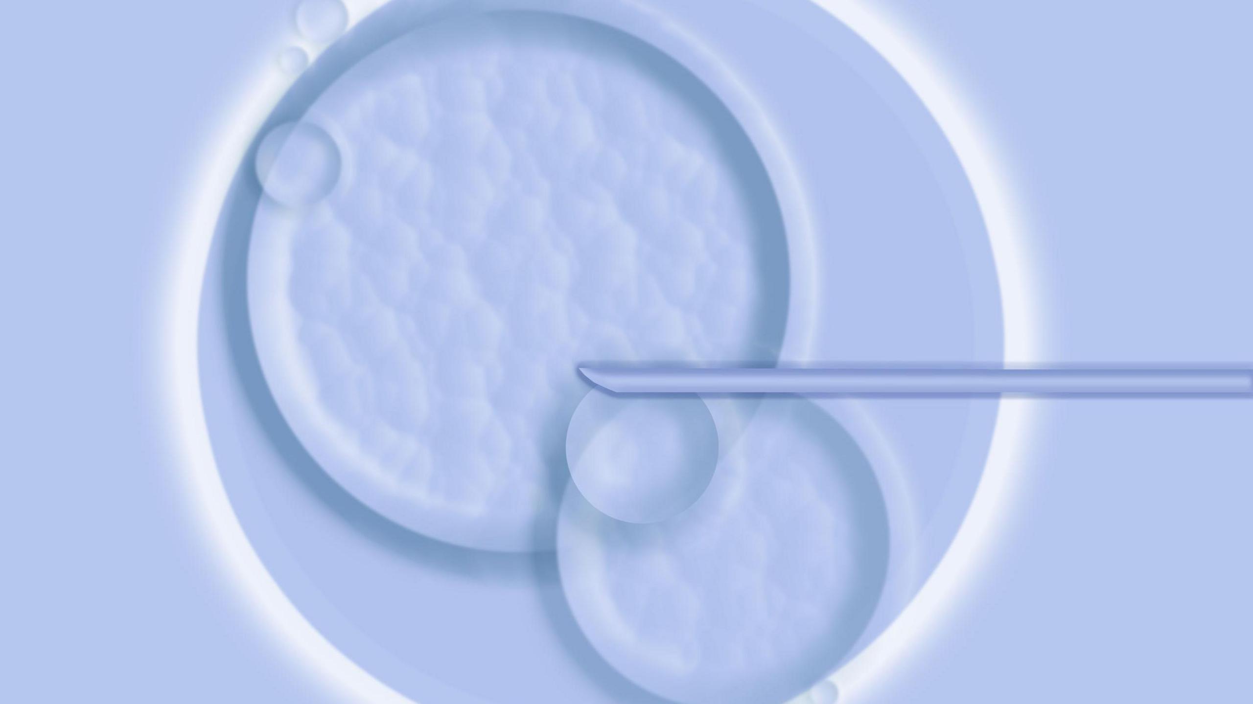 IVF treatment image