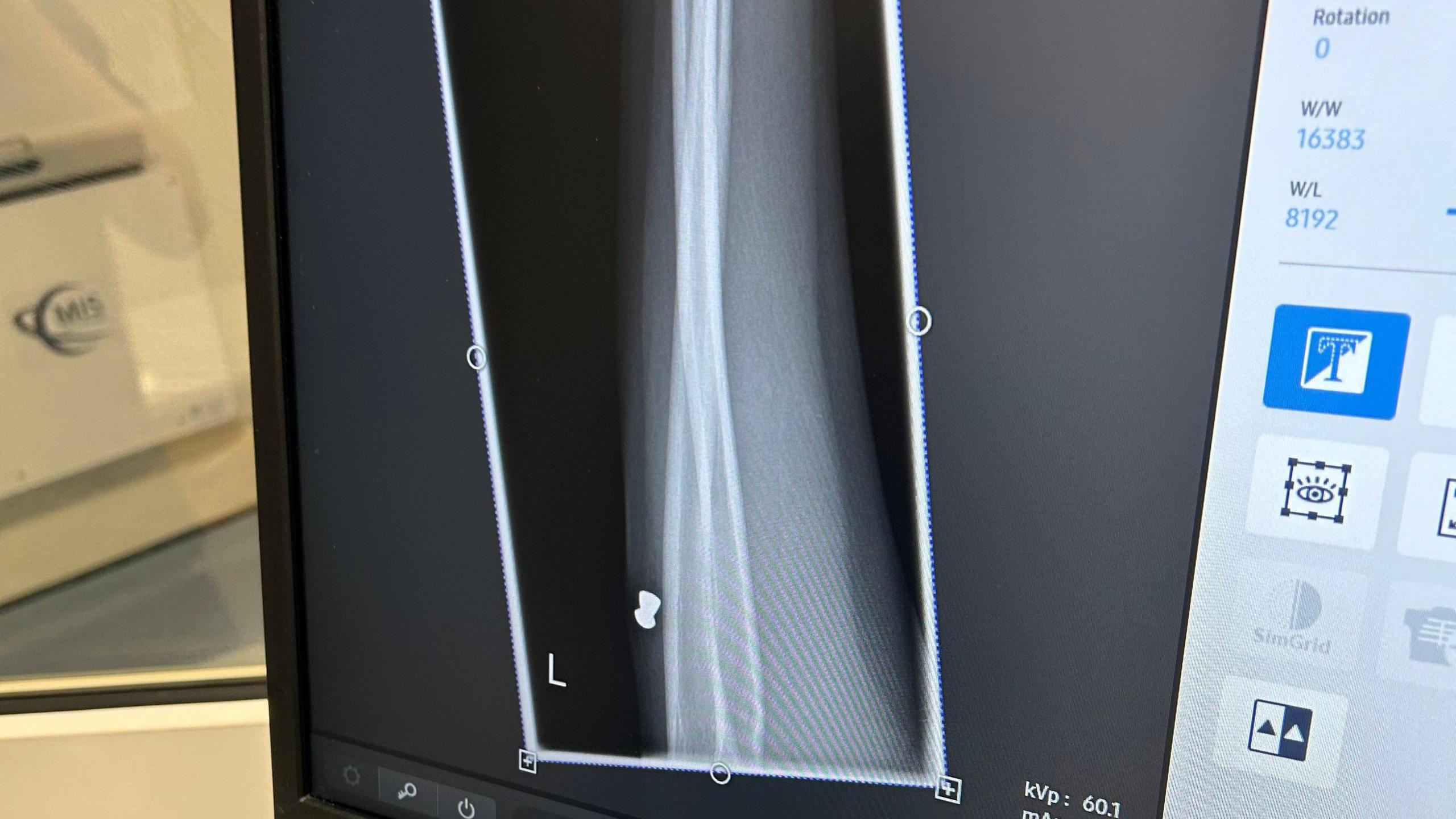 An x-ray image