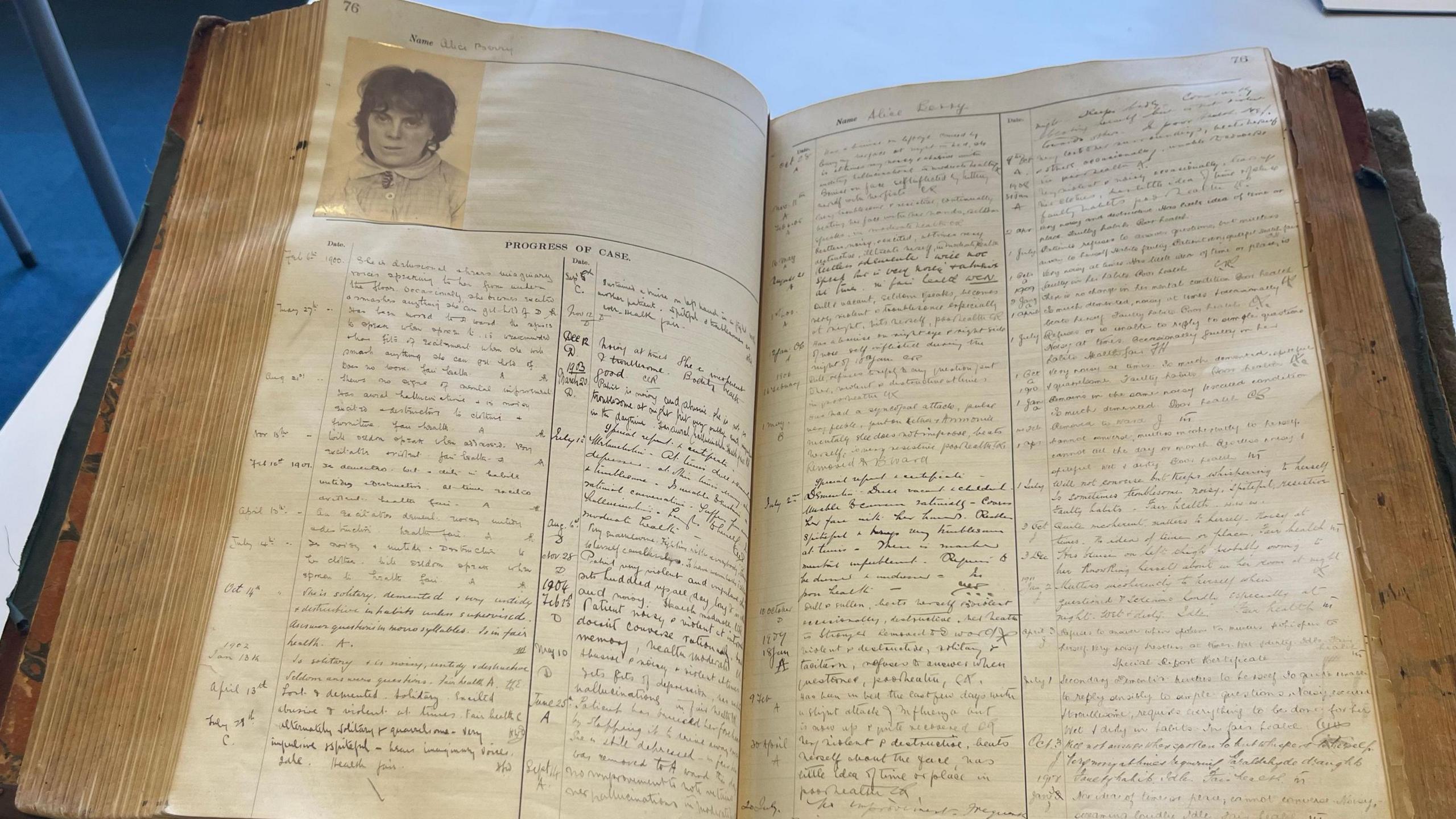 A handwritten hospital record book is filled with notes about patients 