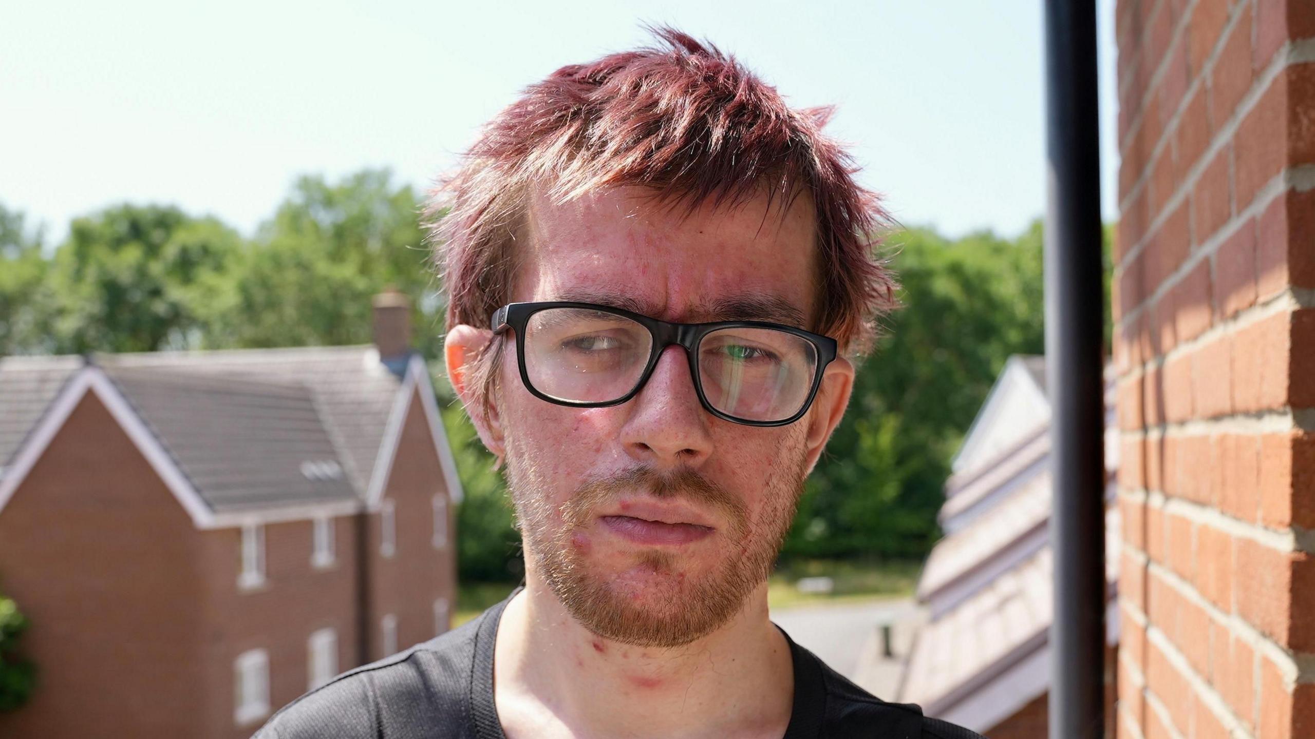 A man with light brown hair and short beard who is wearing glasses standing on a balcony. There are houses in the background. He is looking thoughtful.