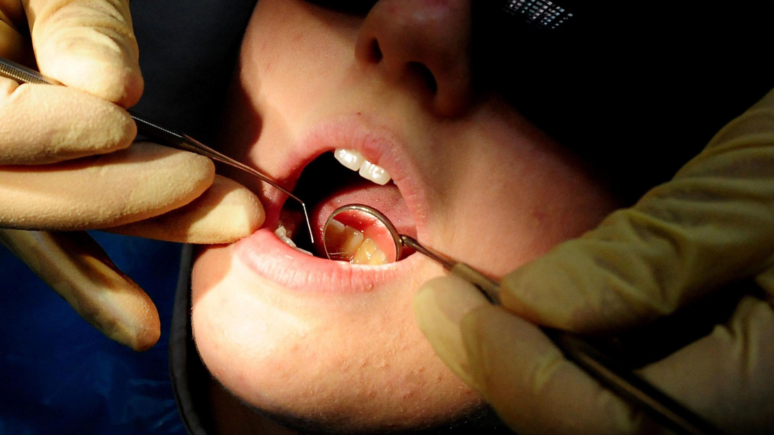 Dentist uses tools to examine a child's teeth