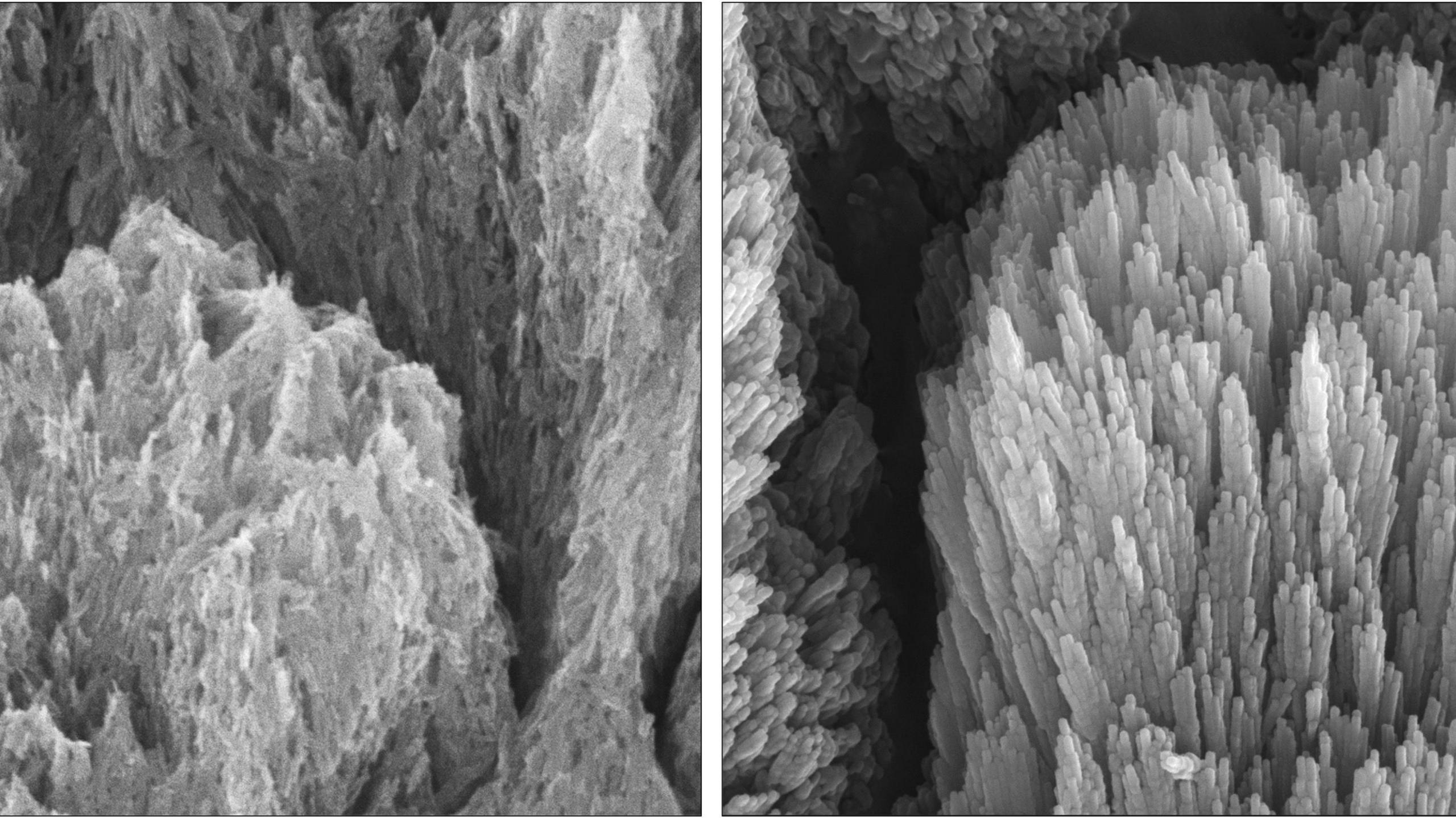 Electron microscopy images of a tooth with demineralised enamel and another tooth after treatment