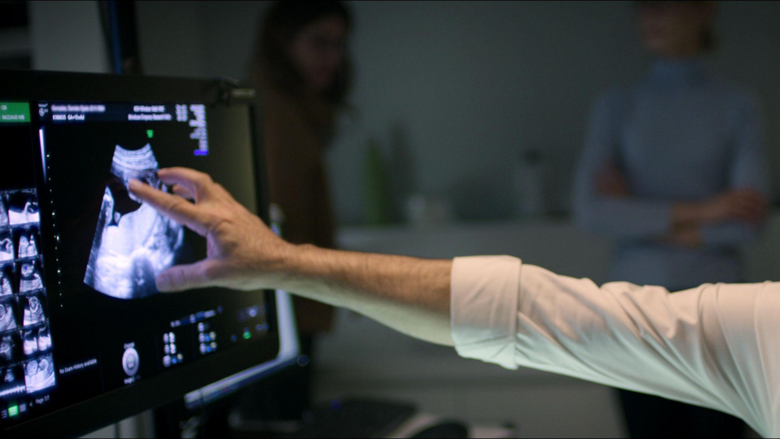 A screen with a baby scan on and a man's arm pointing at it. He is wearing a shirt with a long white sleeve folded up.