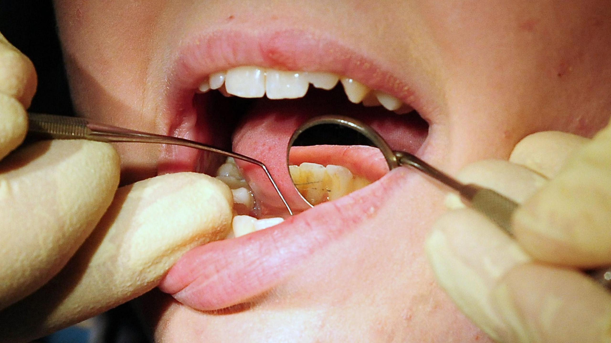 Dental patient