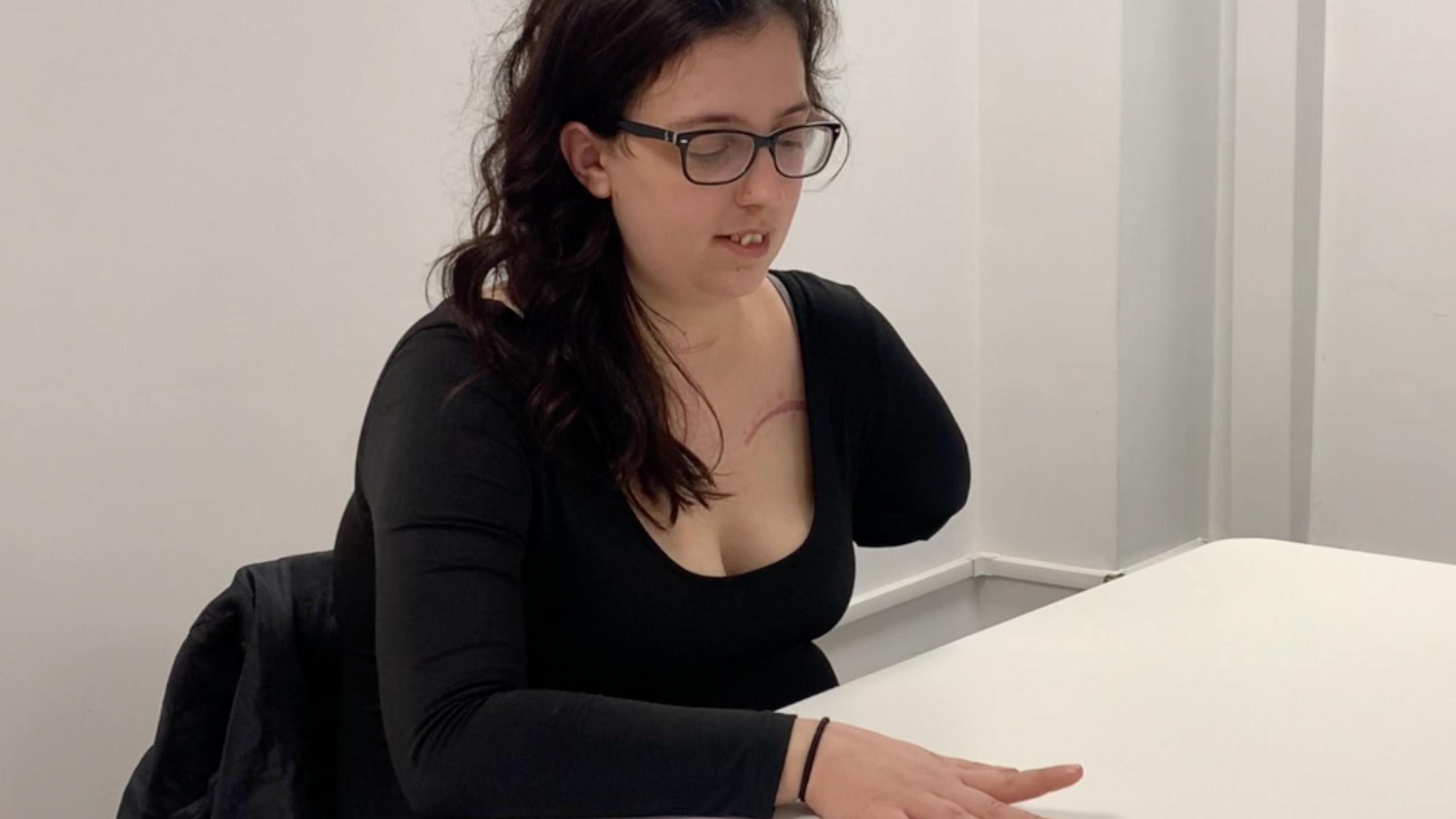 Emily Wheldon, a participant in the study, has long dark hair and is sitting at a white table in a white walled room. She has one hand on the table and is lifting her finger. Her other arm has been amputated. She is wearing a long black top and black framed glasses.