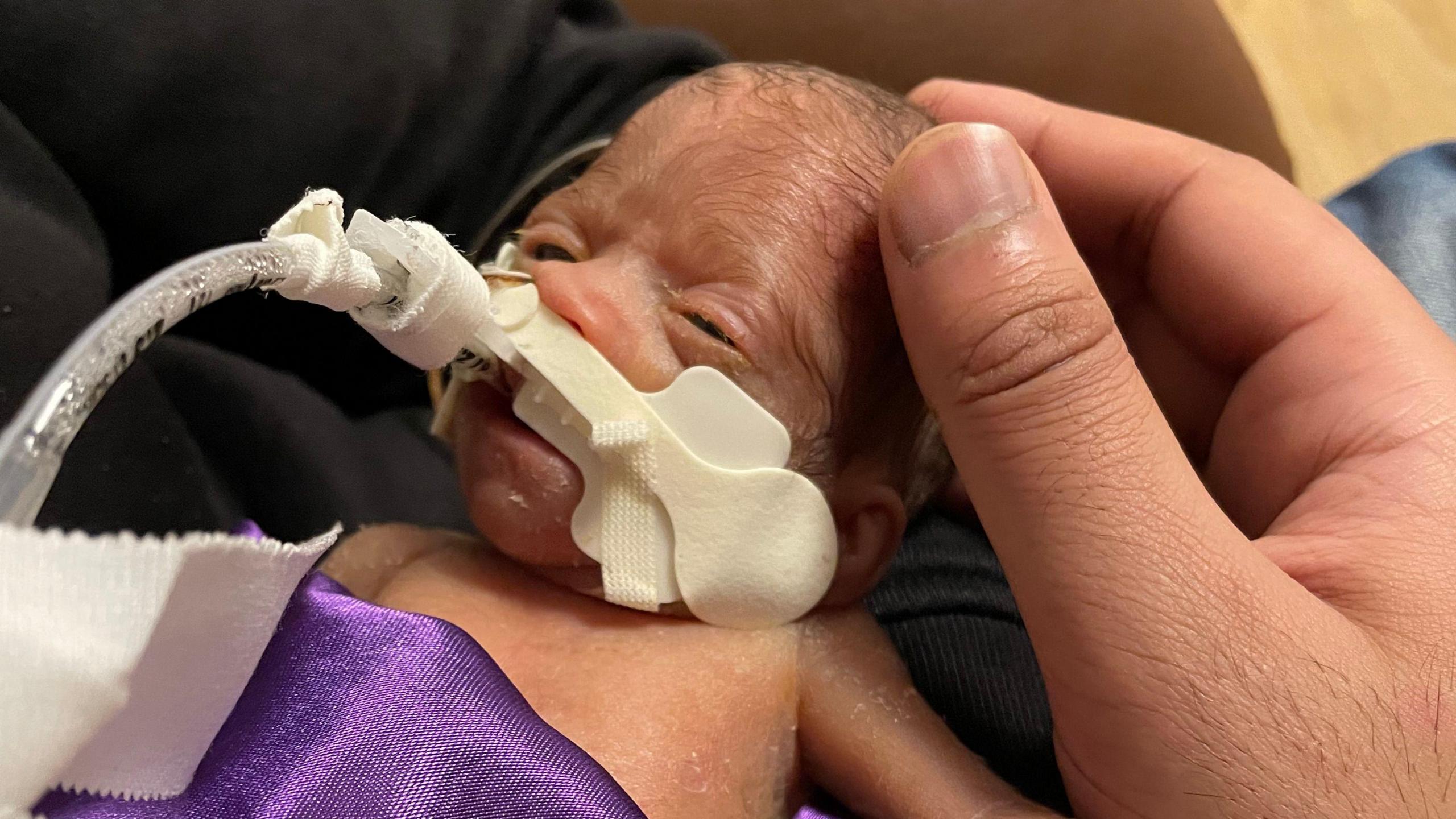 Mother's hand cradles premature baby's head