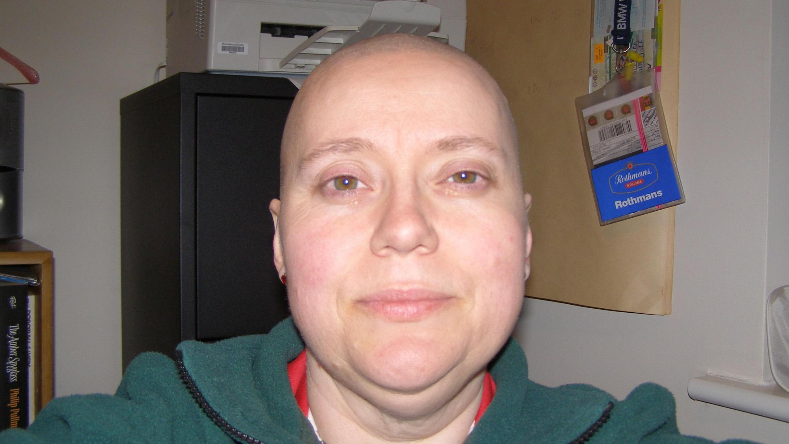 A close-up image of Ms Caruth while she was undergoing her breast cancer treatment. She is bald as a result of the chemotherapy and she is smiling at the camera. A printer on a cupboard is behind her while a lanyard hangs on the wall to her right.