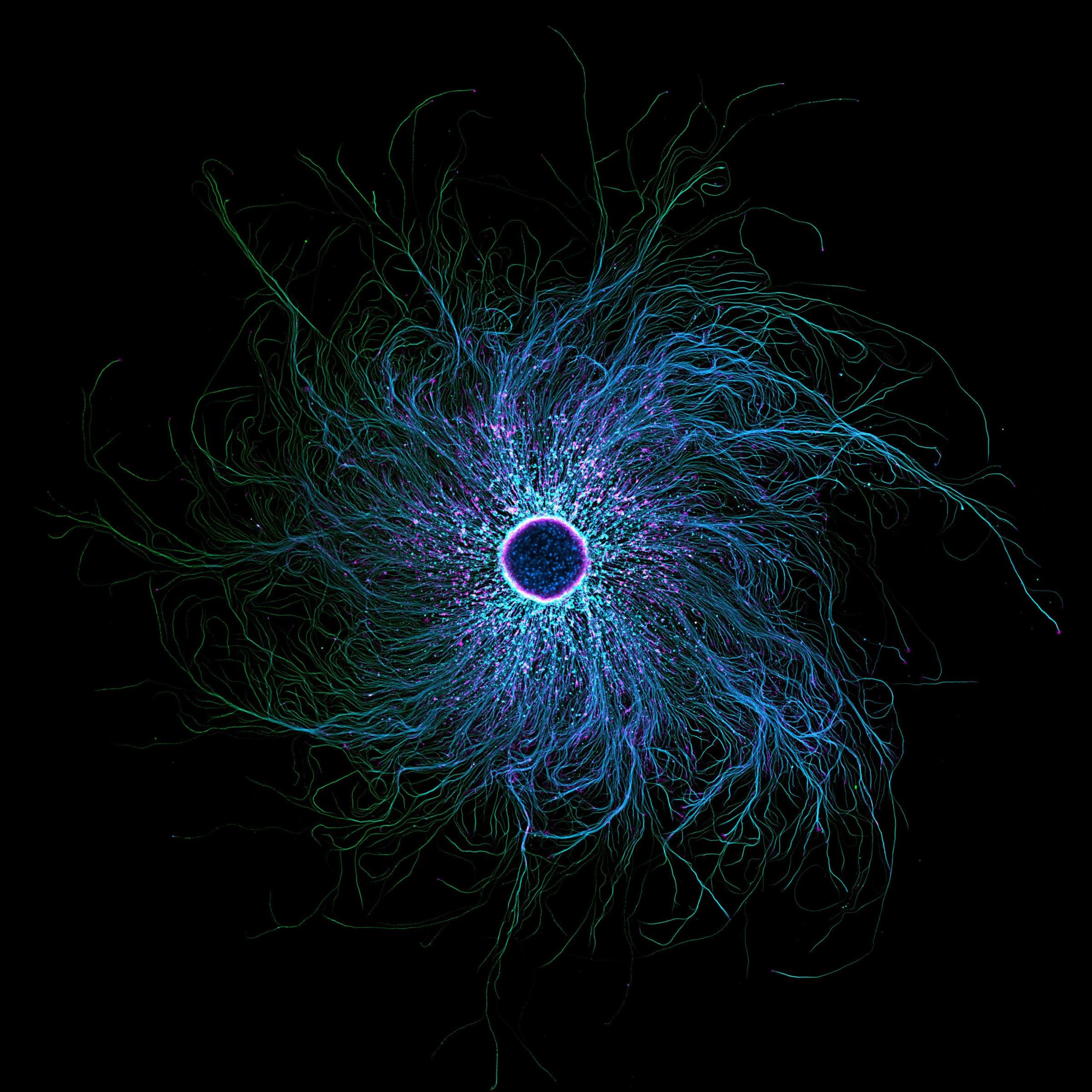 Sensory neurons.