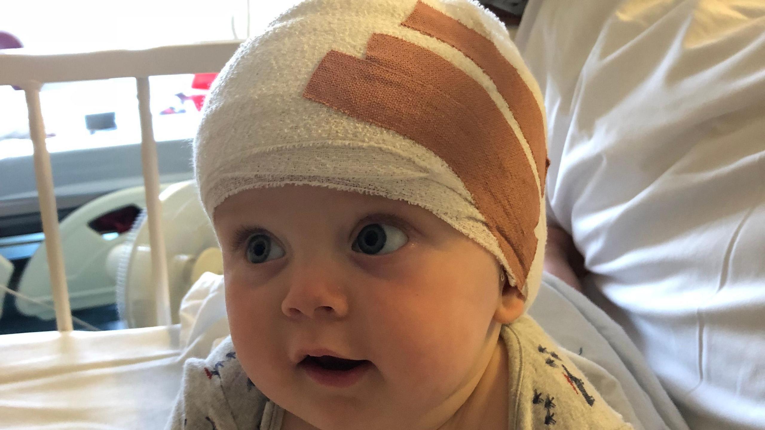 A young baby with a white bandage round his head after surgery.