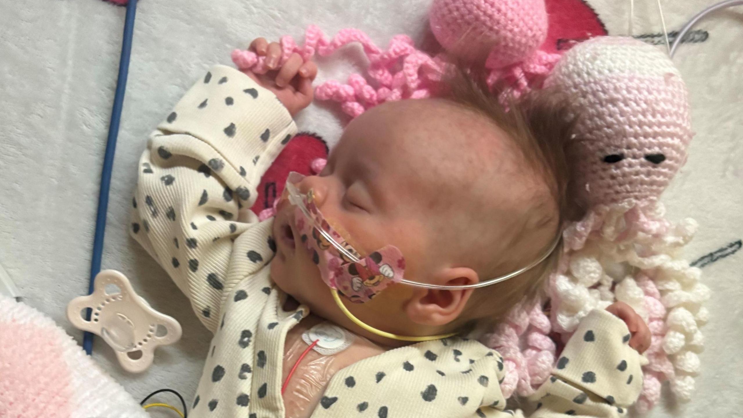 A young baby with two tubes coming out of her nose is sleeping. A medical line attached to her chest is visible underneath her cream babygrow. A dummy and crochet octopuses can be seen around her.