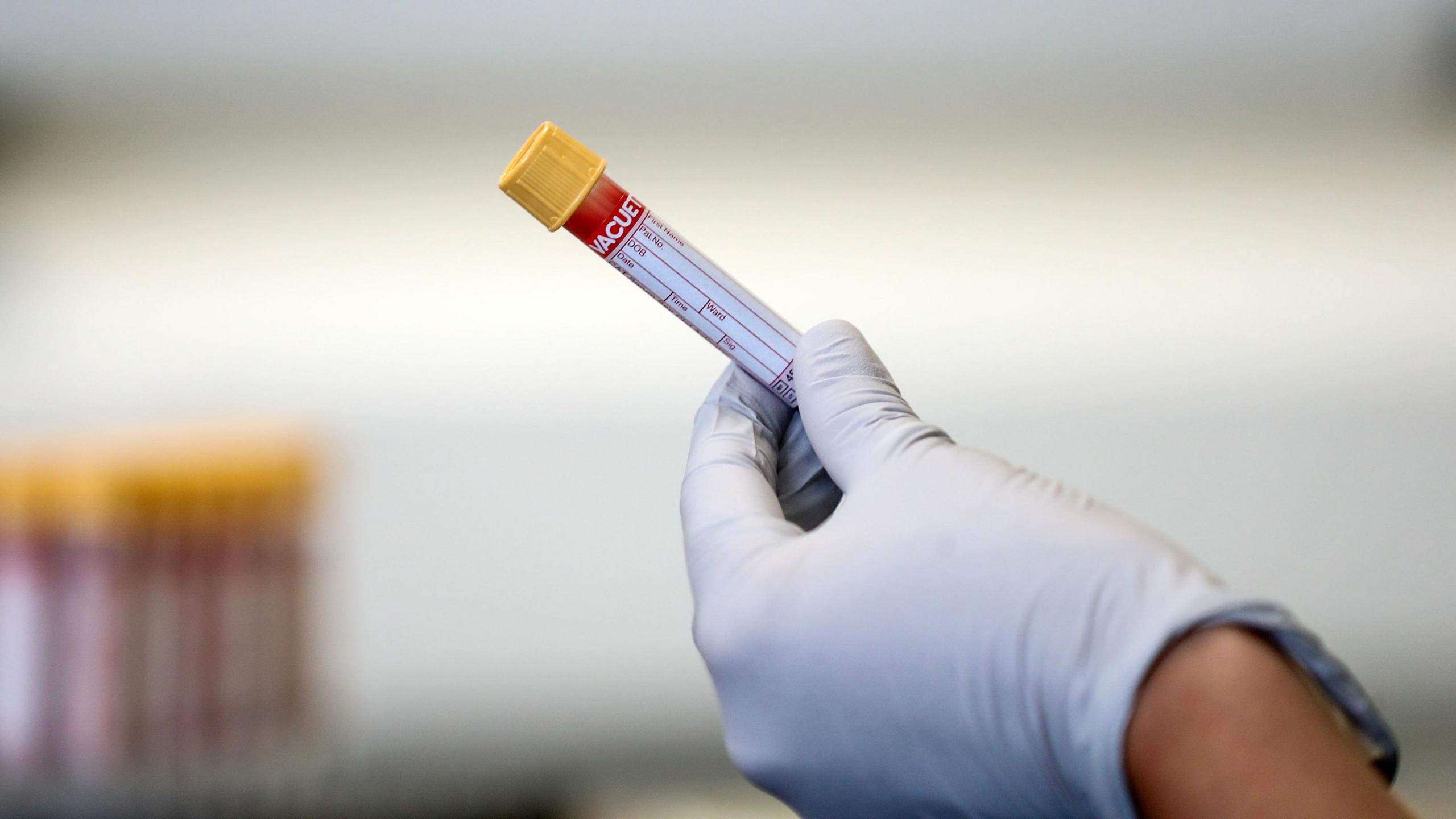 A hand in a white lab glove, holding a test tube with blood sample