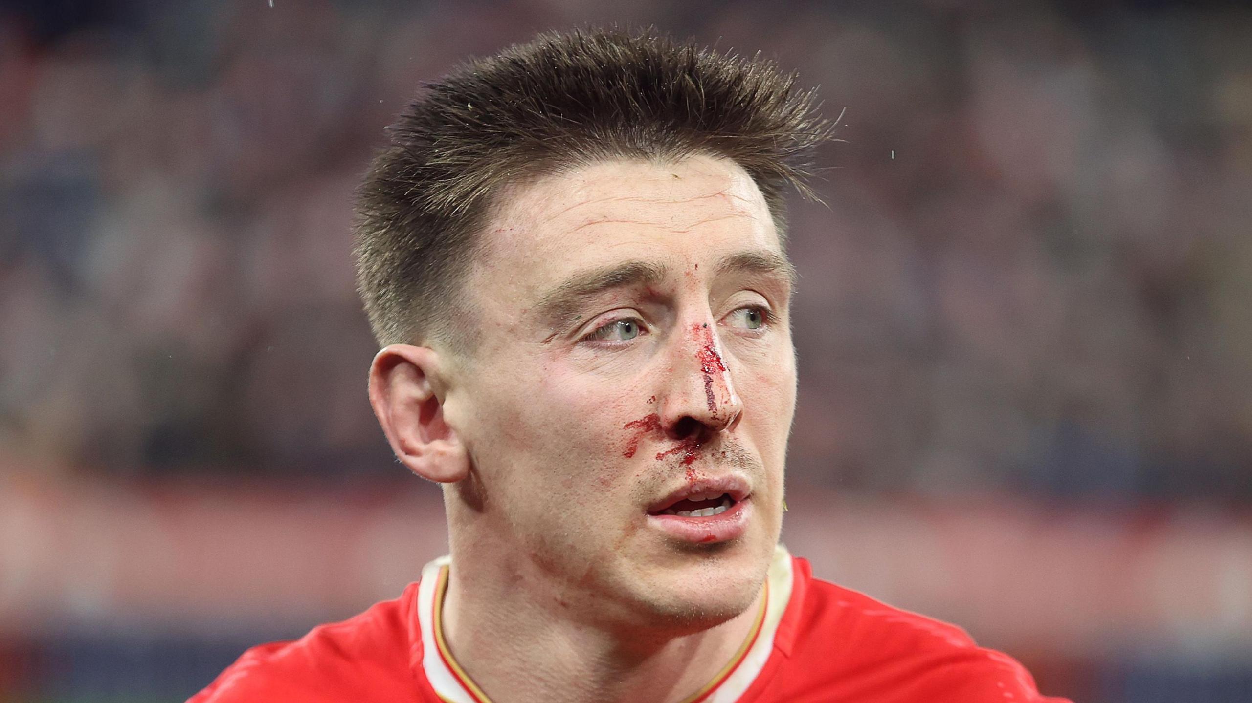 Josh Adams with a bloody nose while playing for Wales against France