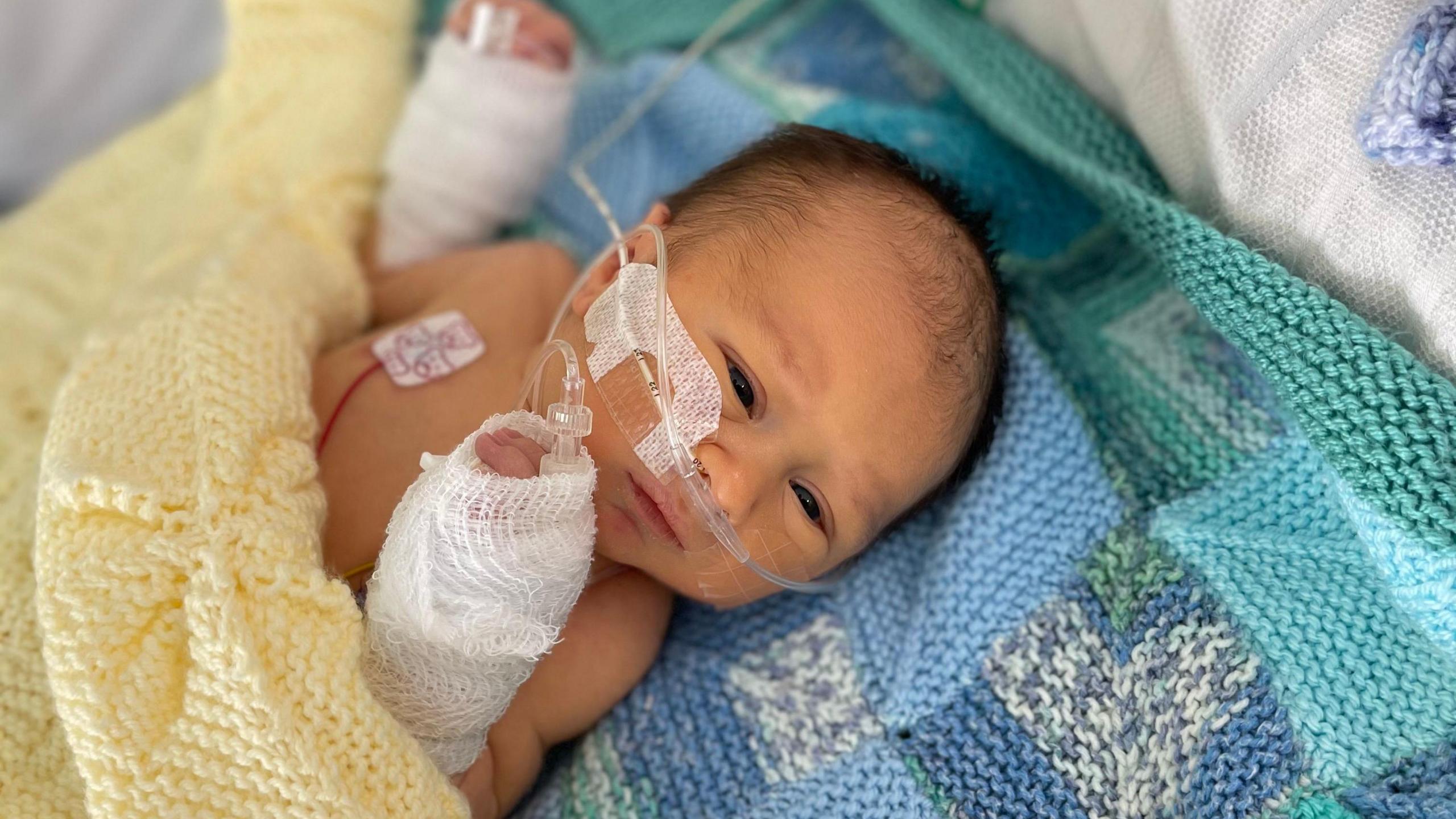 Baby Jenson in hospital after his collapse