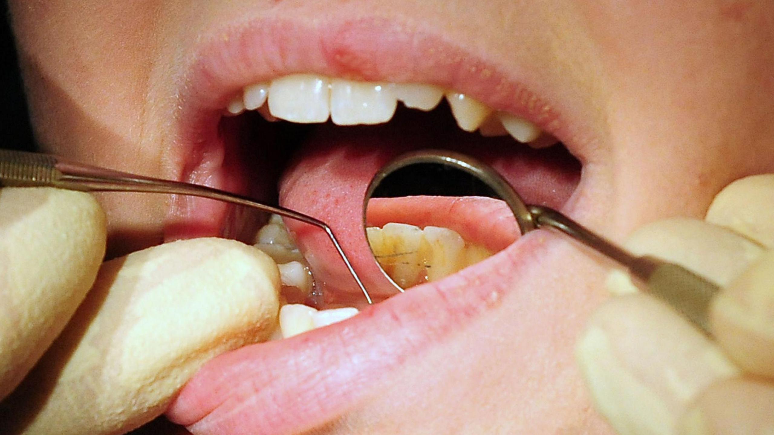 Patient undergoing dental check up