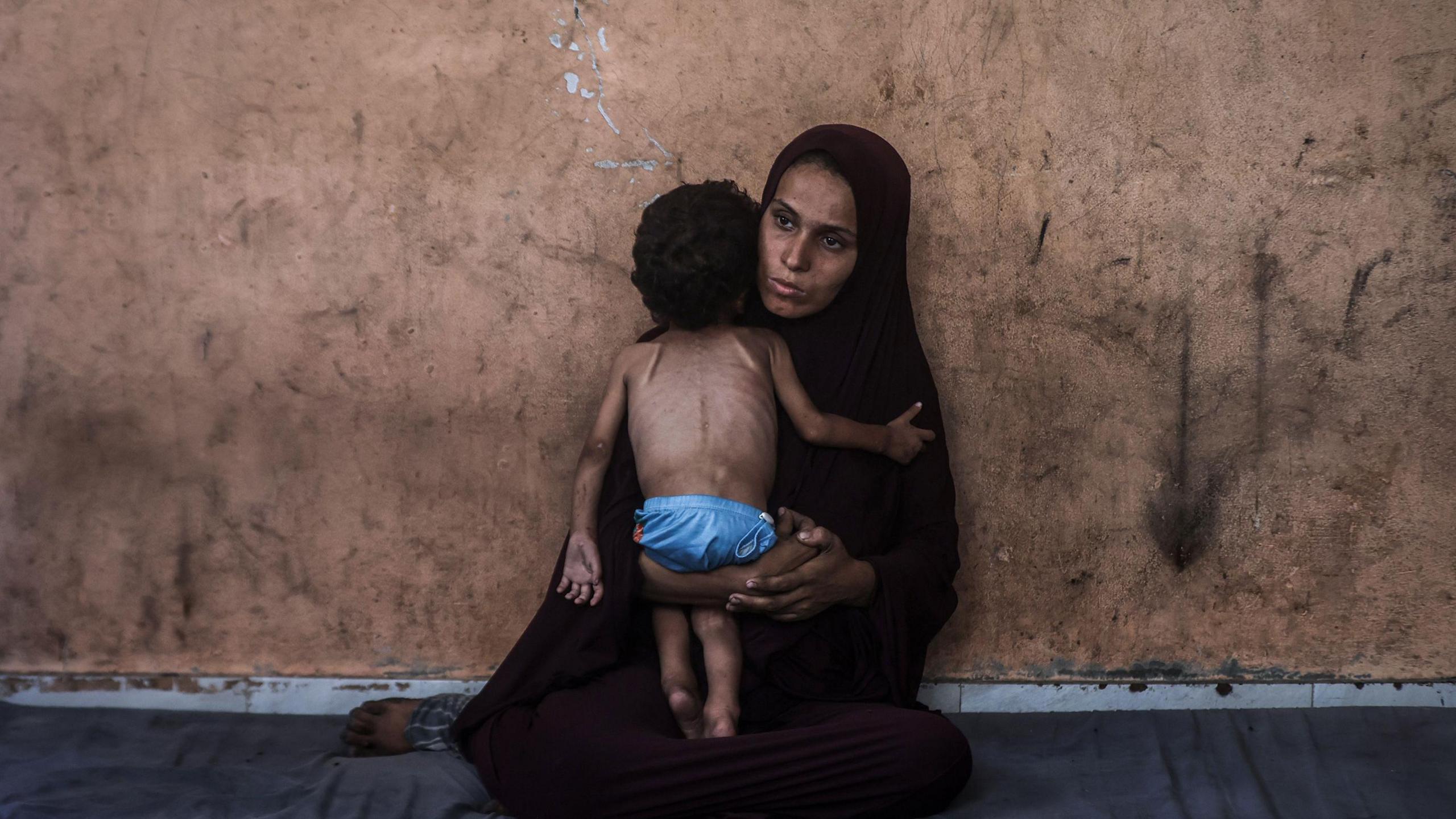 A mother sits on the floor holding her two-year-old daughter. Her daughter, wearing only underwear, has her back to the camera and her ribs are clearly visible.