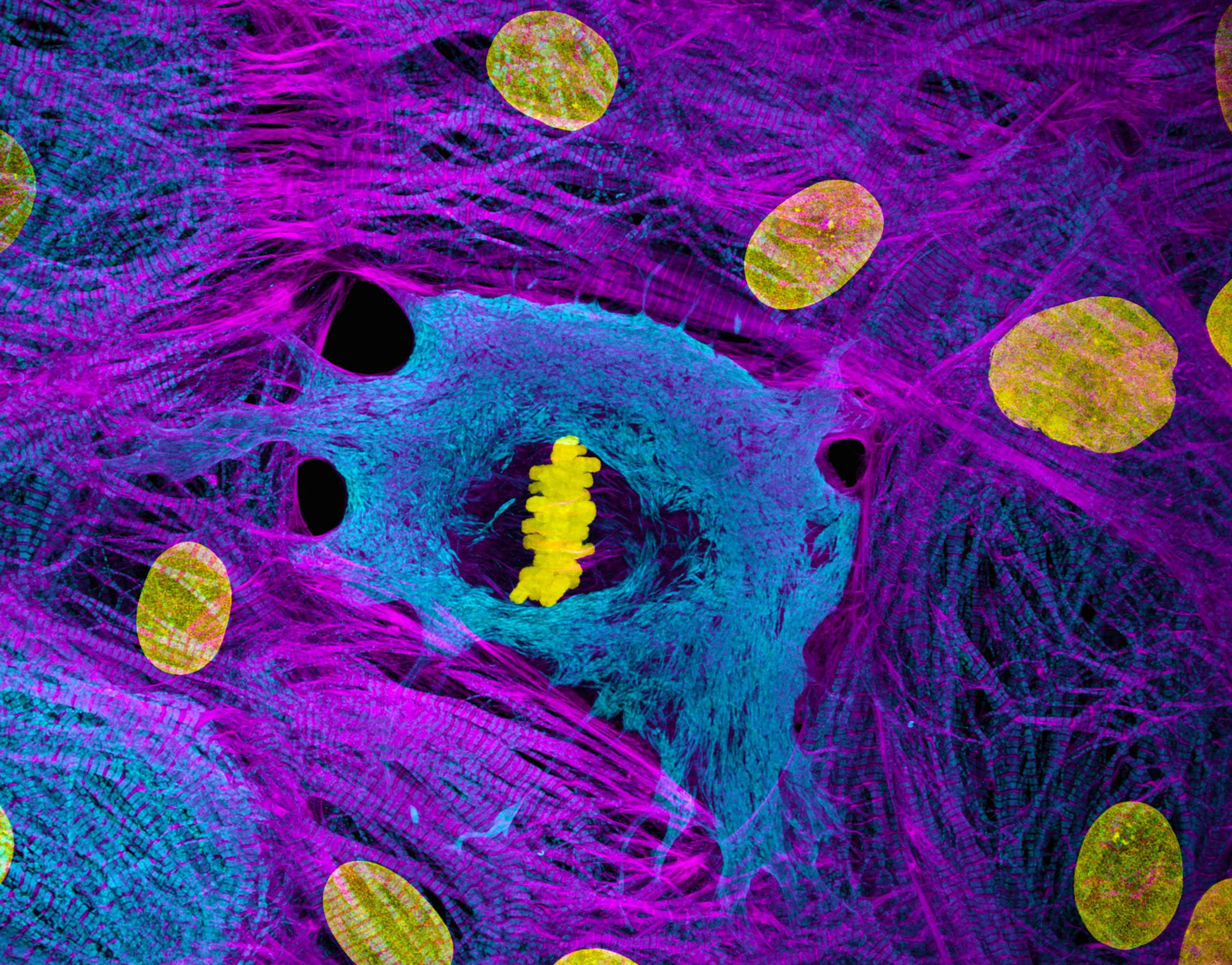Heart muscle cells showing condensed chromosomes in metaphase.