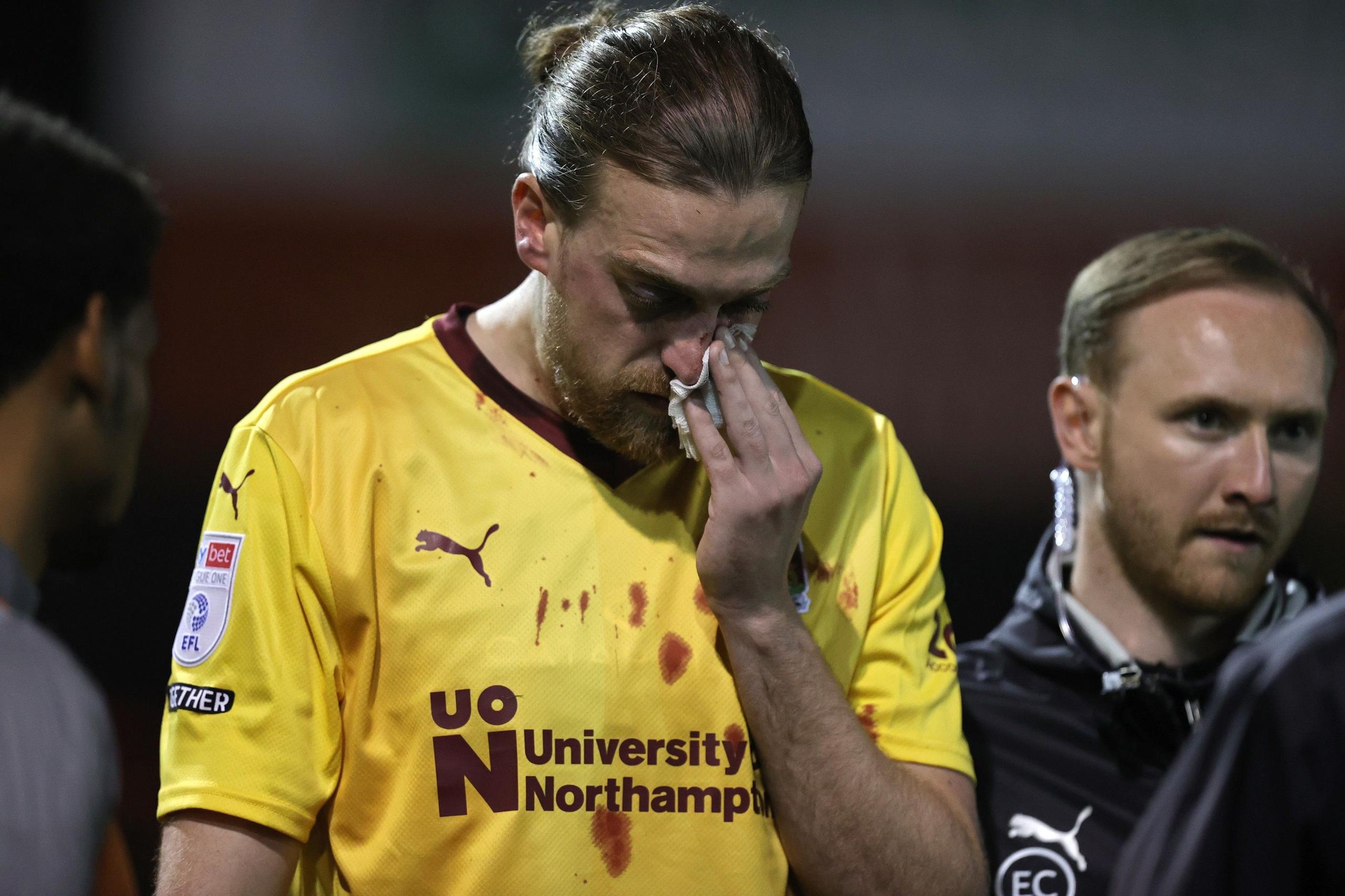 Tom Eaves leaves the pitch against Lincoln after suffering serious facial injuries