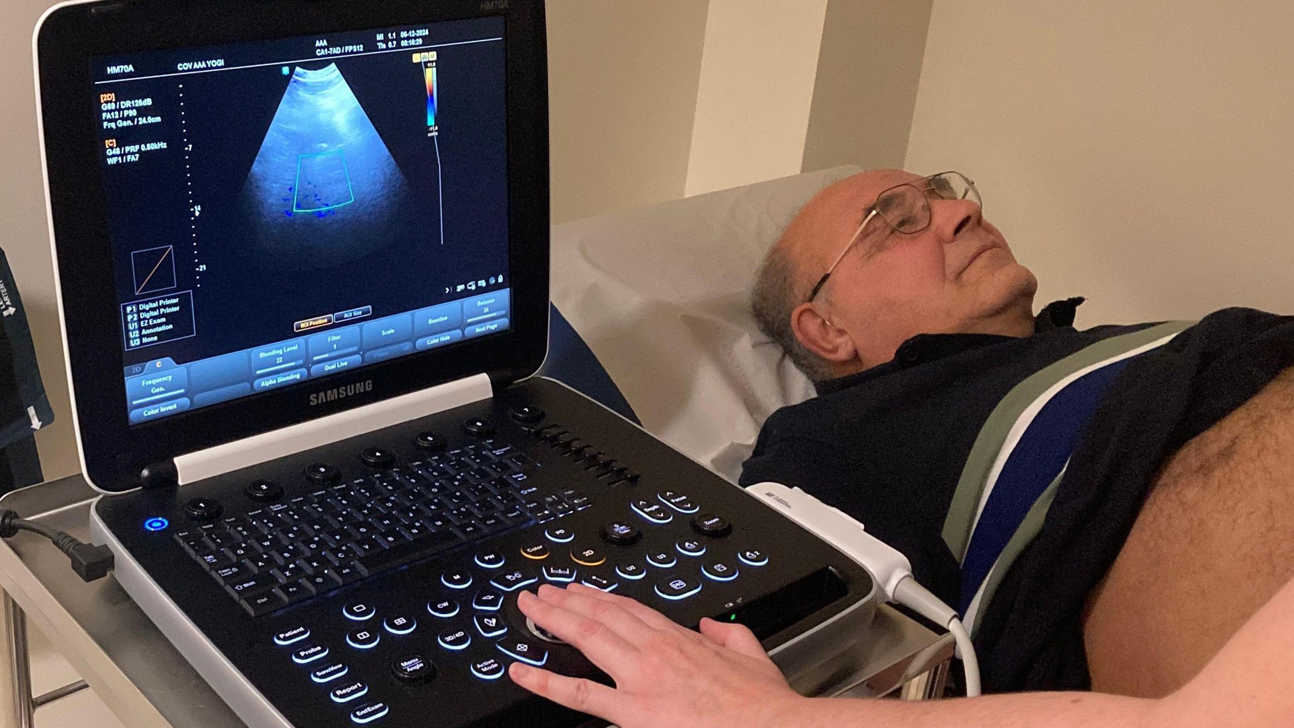 A man with glasses lies  with his eyes closed on a medical bed with his shirt pulled up half way. To his left is an ultrasound scanner screen with a control panel below it. A nurses hand is on the panel. More medical equipment hangs on the wall to the left of that.