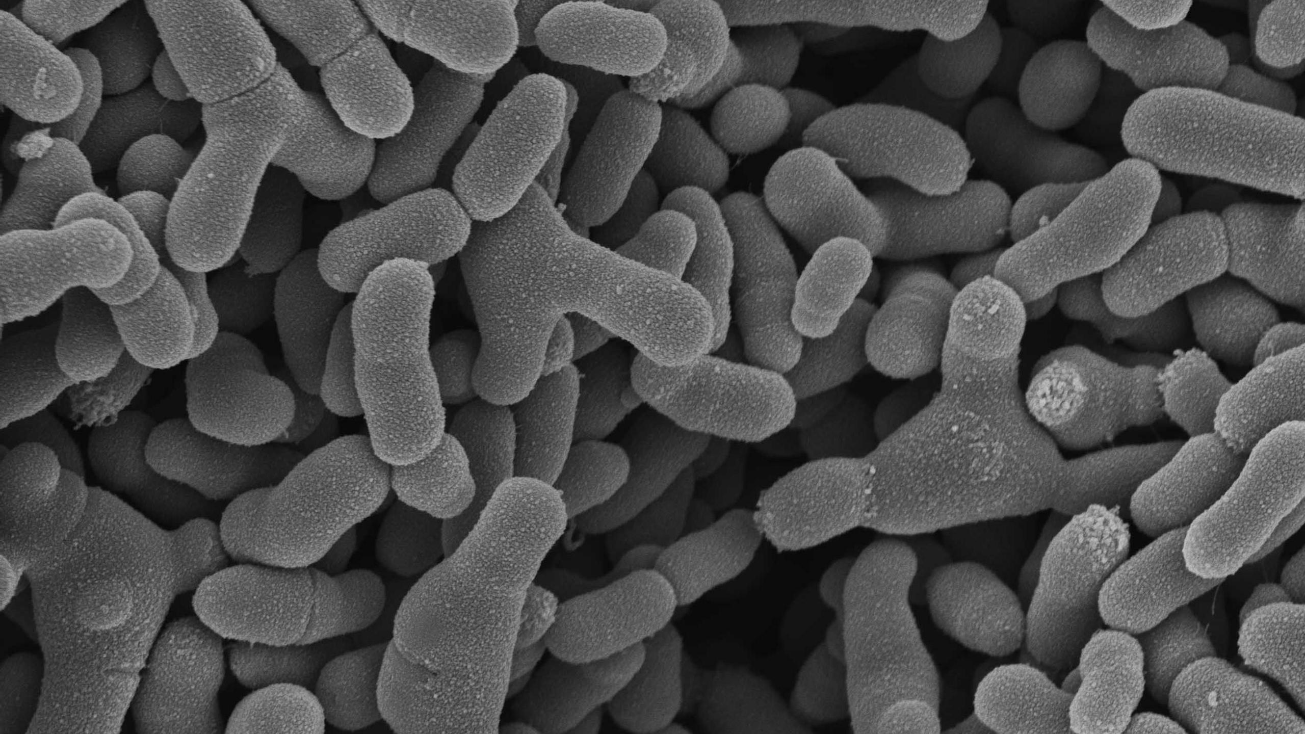 A black and white electron microscope picture of bacteria found in babies' guts 