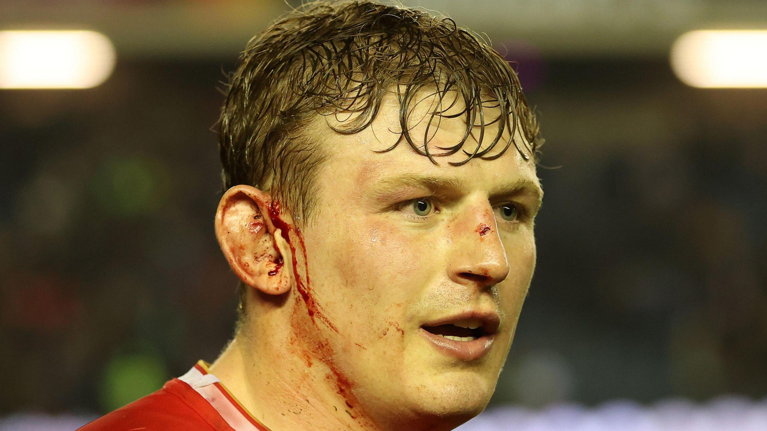 Jac Morgan, who has played 22 internationals for Wales, has blood on his face.