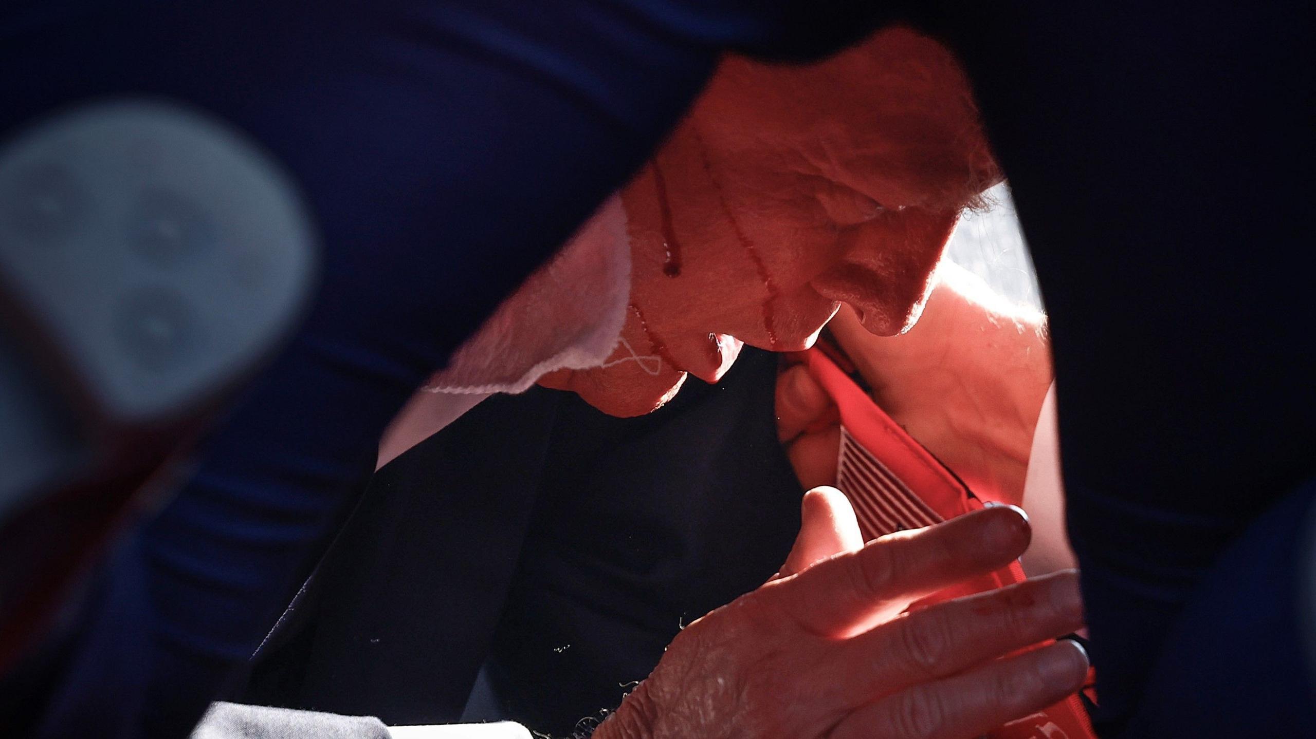 Trump with blood on his face