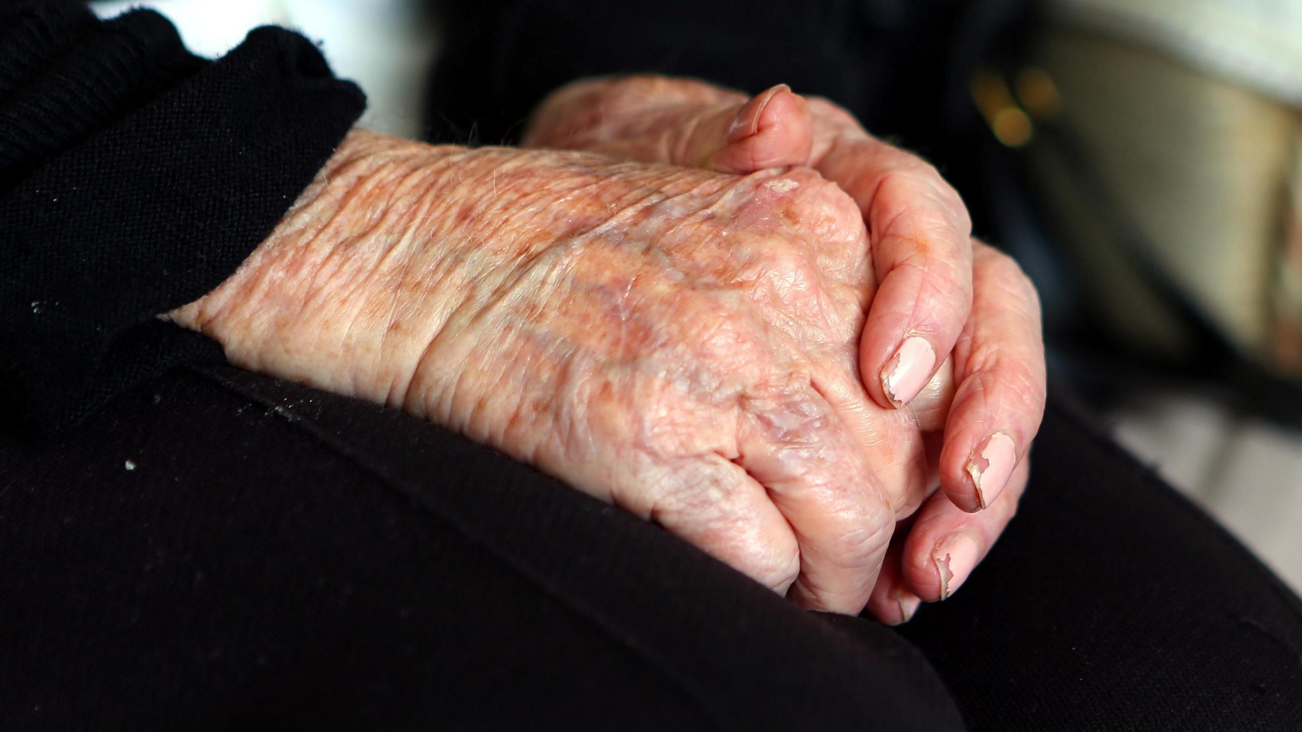 An elderly lady's hands clasped together with chipped nail varnish and black clothing