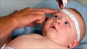 Baby head measurement