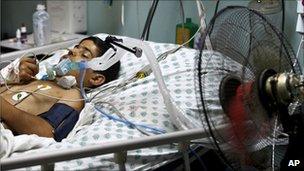 A Palestinian boy in ICU at Shifa hospital, Gaza City, 20 June