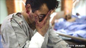 A man waits in a Kabul hospital to receive treatment after a suicide bomber attacked Kabul on 18 July