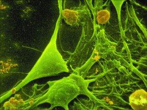 Nerve cells, SPL