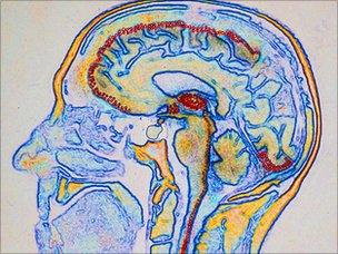 Diagram of sensory areas in human brain, SPL