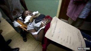 An injured woman in hospital after Kampala bombing
