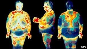 Thermogram of obese people