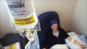 Woman having chemotherapy. Pic: Sam Ogden/SPL