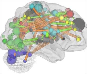 In this diagram, functional connections between brain regions that grow stronger with age are shown in orange, those that weaken are in blue