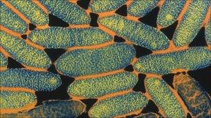 A magnified image of the bacteria Legionella pneumophila, the cause of Legionnaires' disease