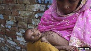 Naushad, 18 months old and suffering from severe malnutrition, lies on his mother's lap Kalonda village in the northern Indian state of Uttar Pradesh 6 September 2010.