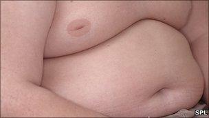 The abdomen of an overweight boy