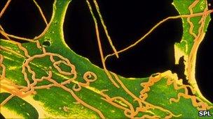 Bacteria that causes syphilis