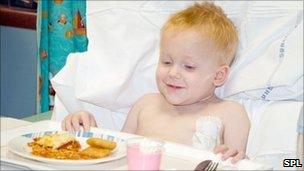 A boy eating food in hospital