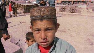 Afghan boy with suspected case of leishmaniasis