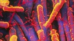 image of clostridium difficile