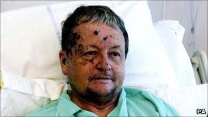 Prof Tulloch, pictured in hospital a few days after the bombings in 2005