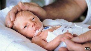 A premature baby