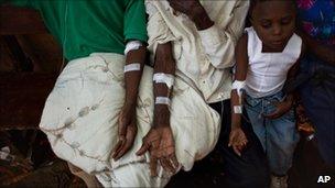 Patients receive treatment at a hospital in Limbe, near Cap Haitien.