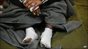 Injured Eritrean asylum-seeker