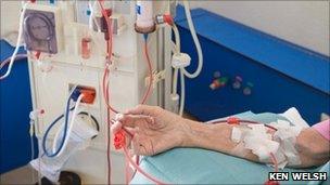 A person on a dialysis machine (generic)