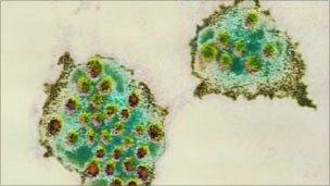 Norovirus particles